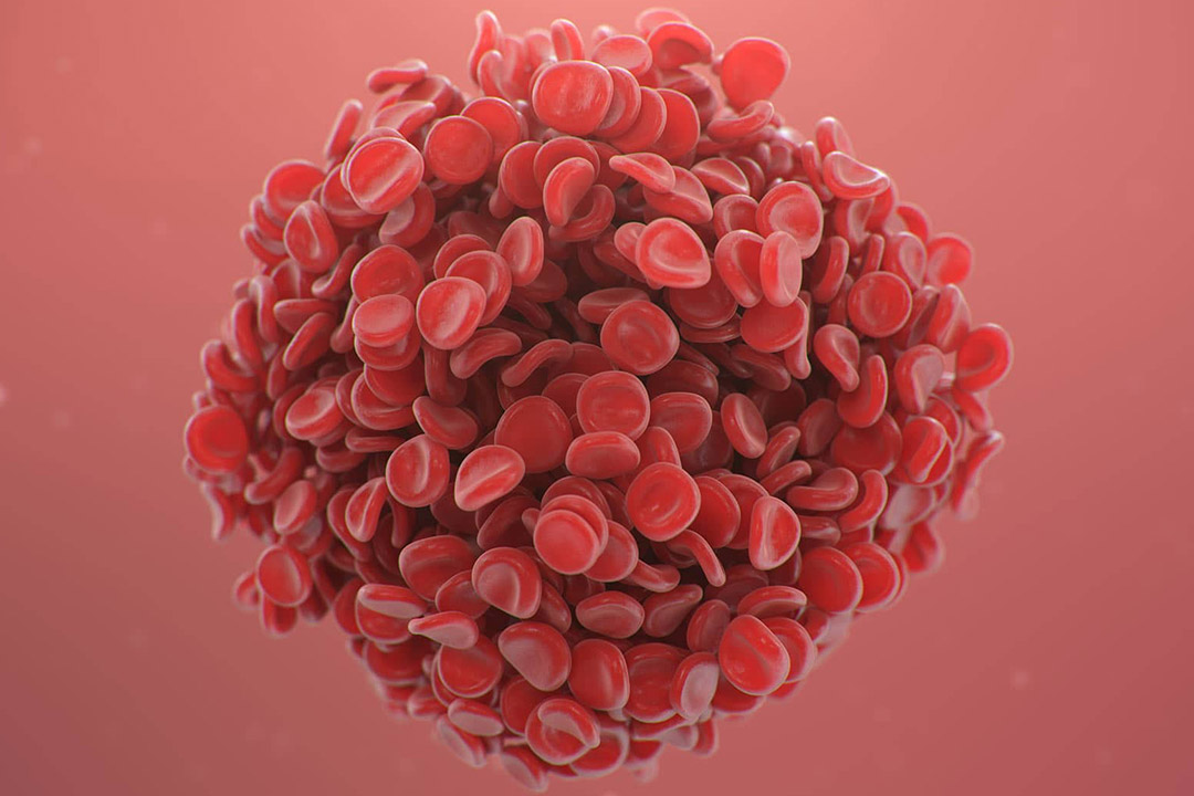 Silvia Menezes Hematologia